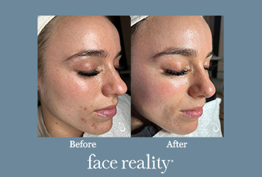 Face Reality Bootcamp before and after